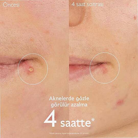 Caudalie Vinopure Akne Karşıtı Salisilik Spot Krem 15 ml - 6