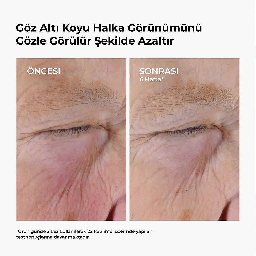 The Ordinary Caffeine Solution 5% EGCG Koyu Halka ve Şiş Görünüm Göz Çevresi Serumu 30 ml - 2