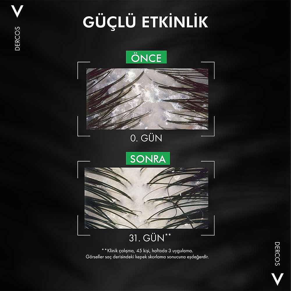 Vichy Dercos Anti Dandruff Kuru Saçlar için Kepek Karşıtı Şampuan 390 ml - 6