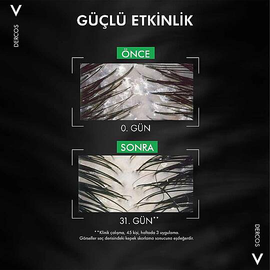 Vichy Dercos Anti Dandruff Normal ve Yağlı Saçlar için Kepek Karşıtı Şampuan 200 ml - 6