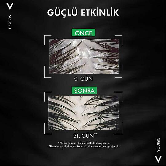 Vichy Kepek Karşıtı Şampuan & Refill Seti - 8