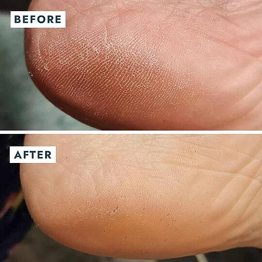 Voesh New York Solemate Topuk Onarıcı Balm 22 ml - 9