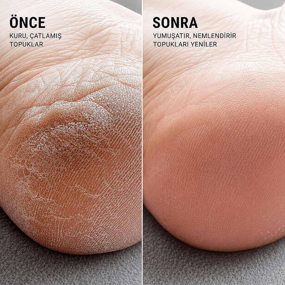 Voesh New York Solemate Topuk Onarıcı Balm 22 ml - 7